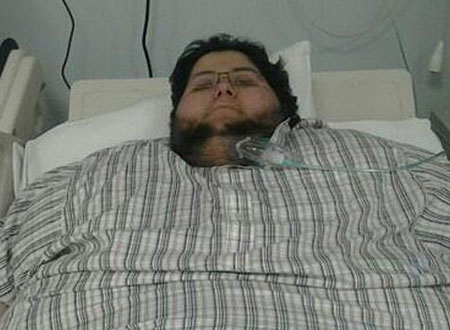 وفاة مريض سمنة سعودي تشعل تويتر 