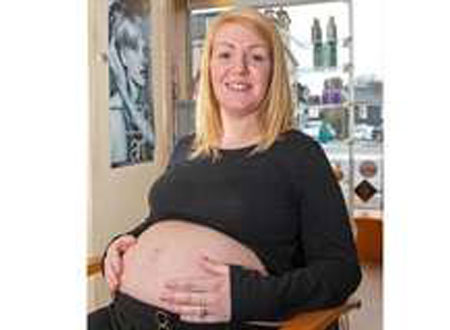 بالصور.. وجه بشري على بطن امرأة بريطانية حامل!