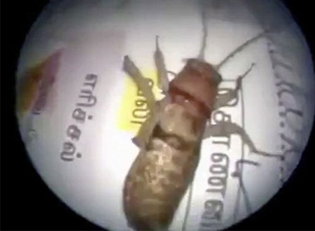 استخراج حشرة حية طولها 3 بوصات تعيش داخل رأس رجل