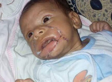 سيدة مصرية تقضم وجه طفلها الرضيع بطريقة بشعة.. صور