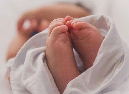 ولادة طفل بدون وجه تهز البرتغال